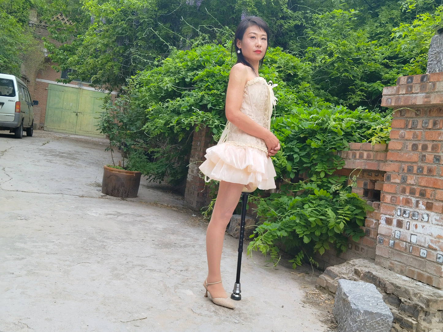 Ayla: Sak Amputee Girl - Learning to Use a New Prosthetic Limb