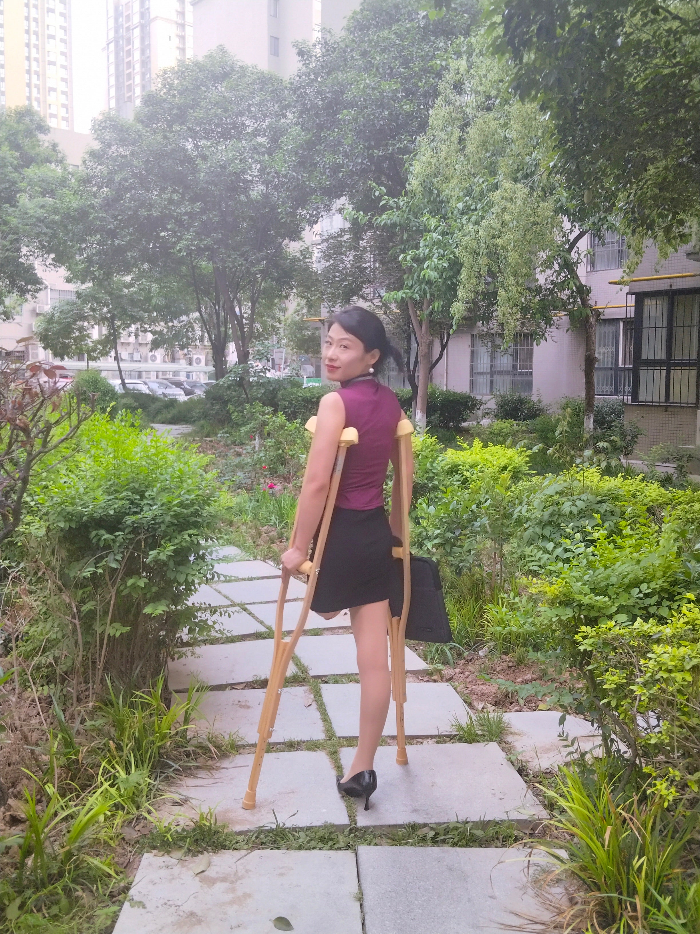 Ayla: Sak Amputee Girl - Learning to Use a New Prosthetic Limb