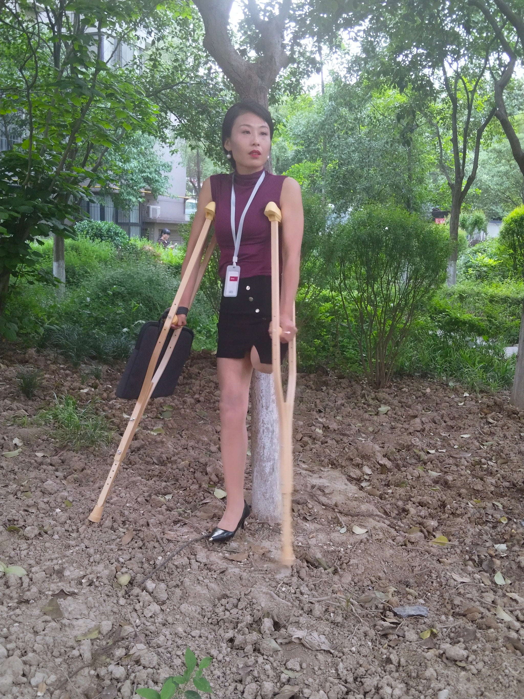 Ayla: Sak Amputee Girl - Learning to Use a New Prosthetic Limb