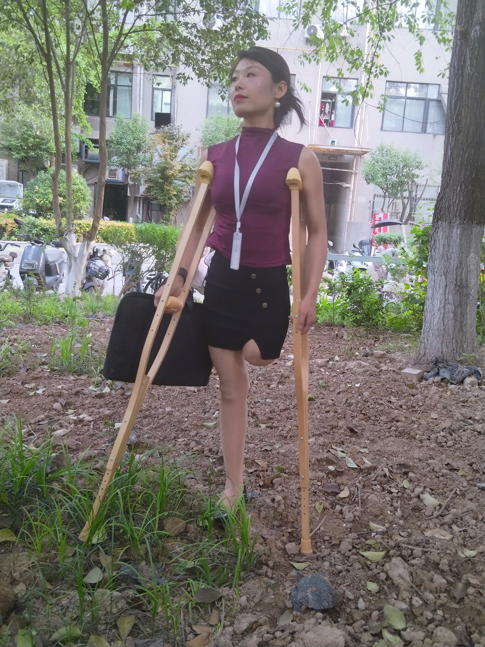 Ayla: Sak Amputee Girl - Learning to Use a New Prosthetic Limb
