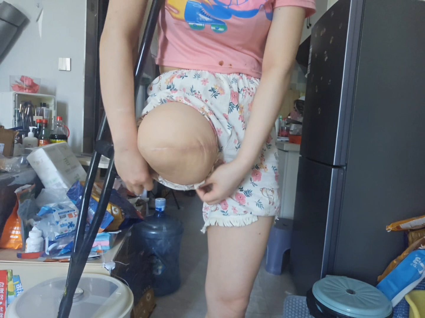 Lingo: Sak Amputee Girl - Demonstrating how to wear a prosthetic leg