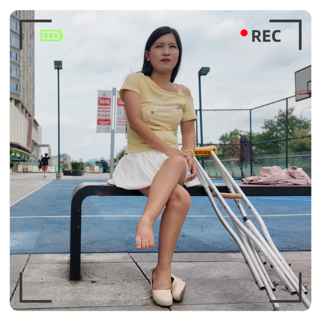 Maria: Polio Girl - The painful struggle of walking on deformed feet