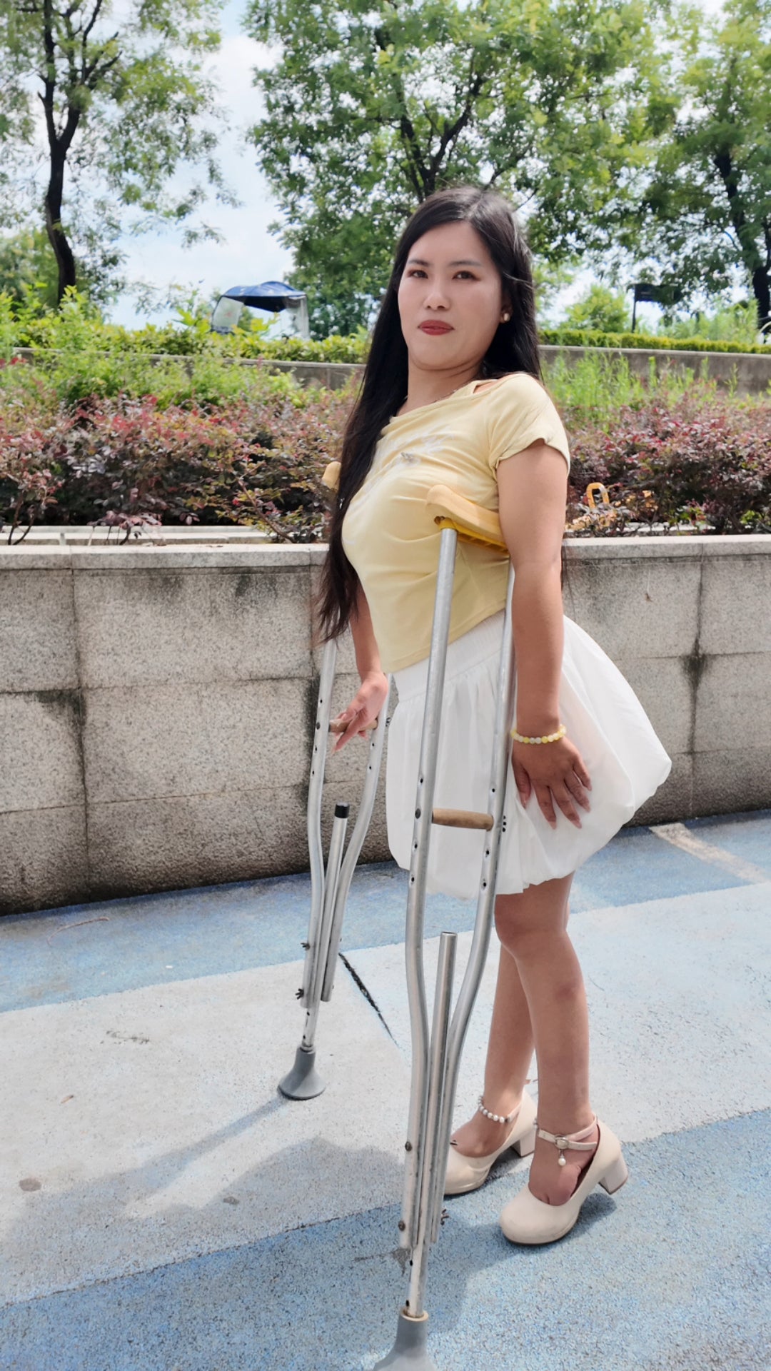 Maria: Polio Girl - The painful struggle of walking on deformed feet