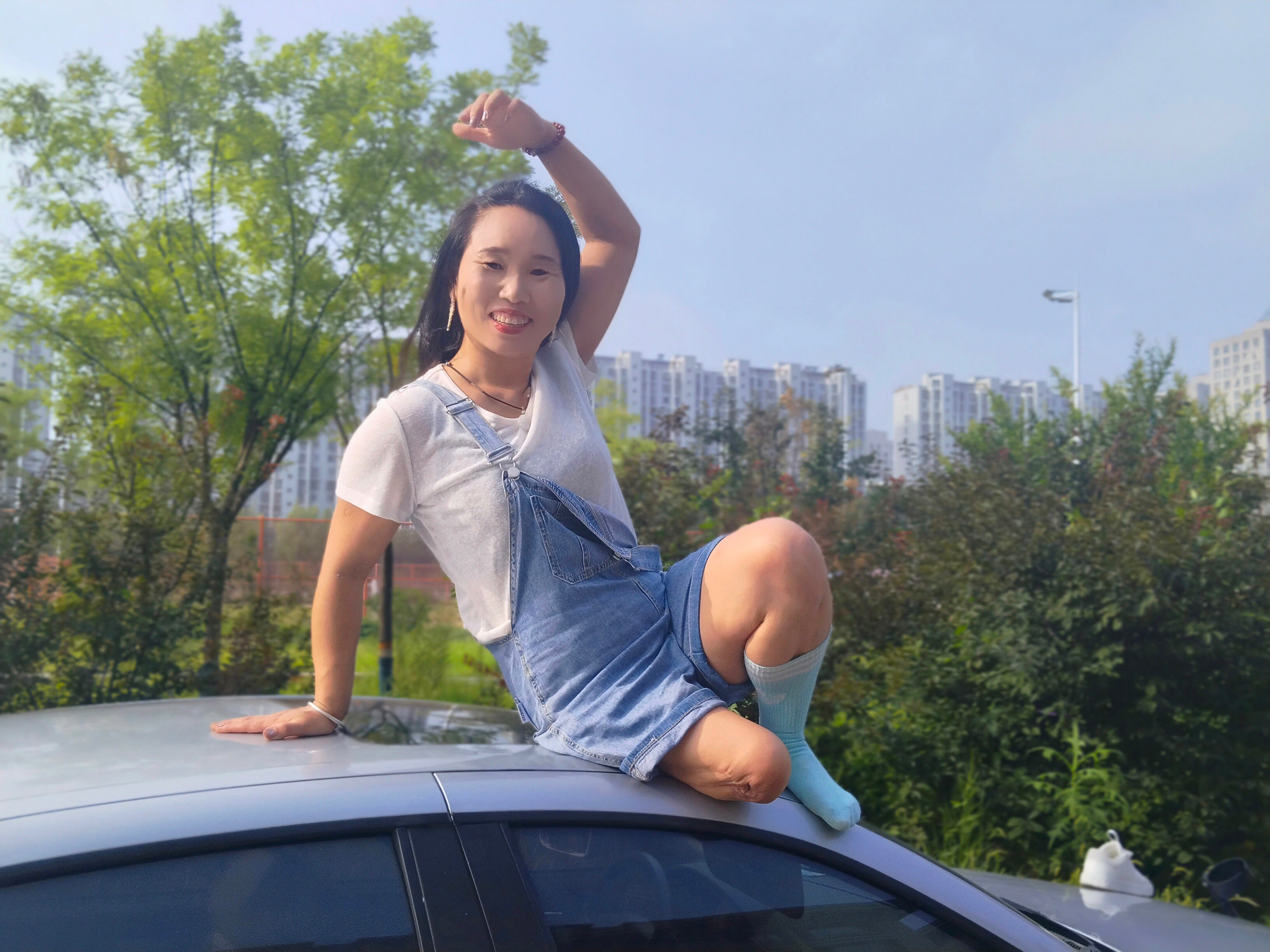 Gigi: Sak Amputee Girl – Out and about on forearm crutches