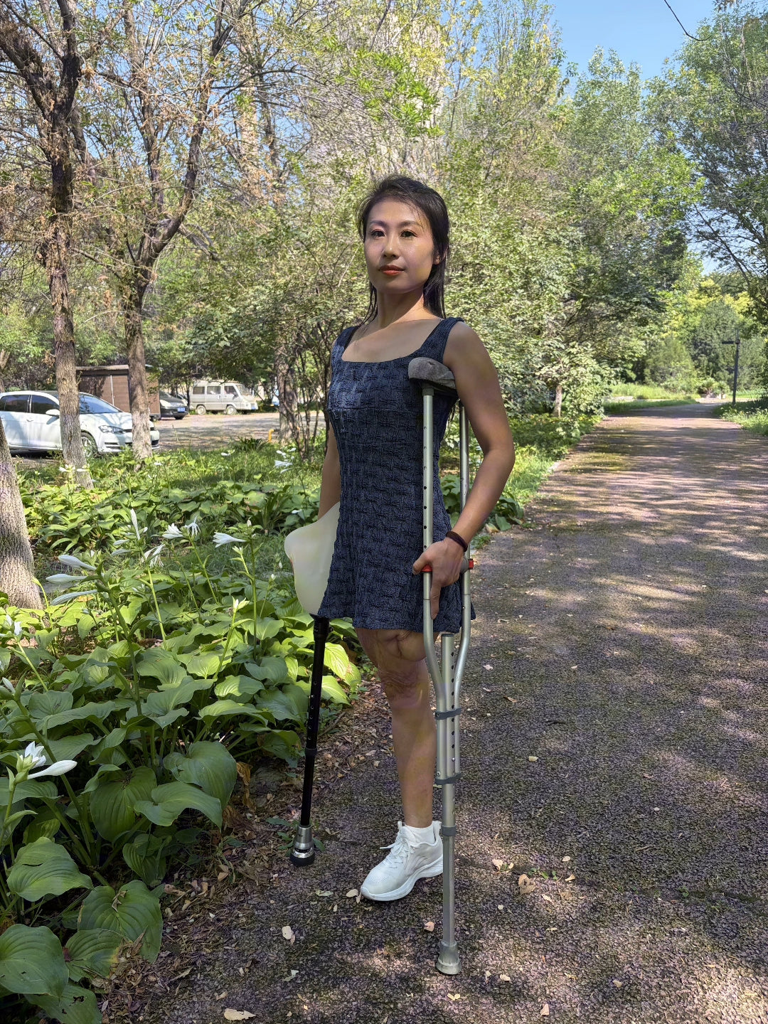 Ayla: Sak Amputee Girl - First Experience with a Wooden Leg Prosthetic