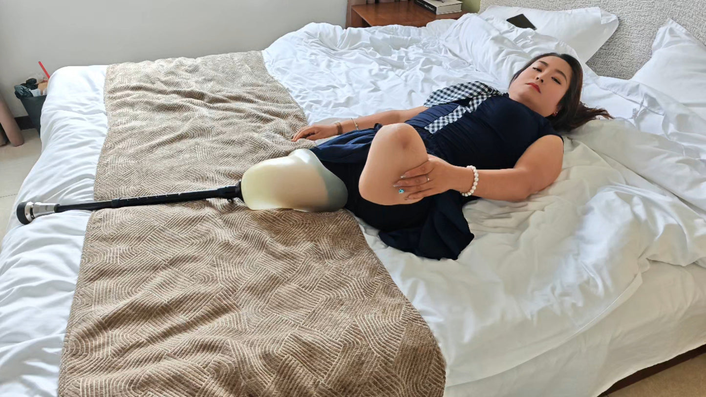 Tina, an Amputee Girl - Limb Cleaning and Care