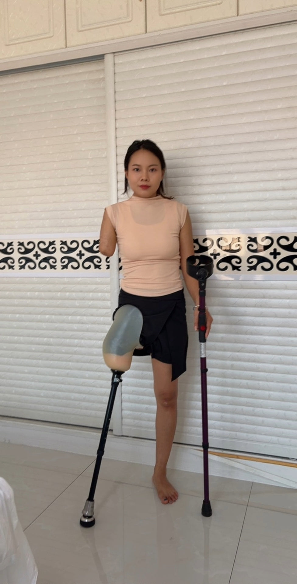 Abby Ooe, the Amputee Girl - From Prosthetic Legs to Wooden Legs