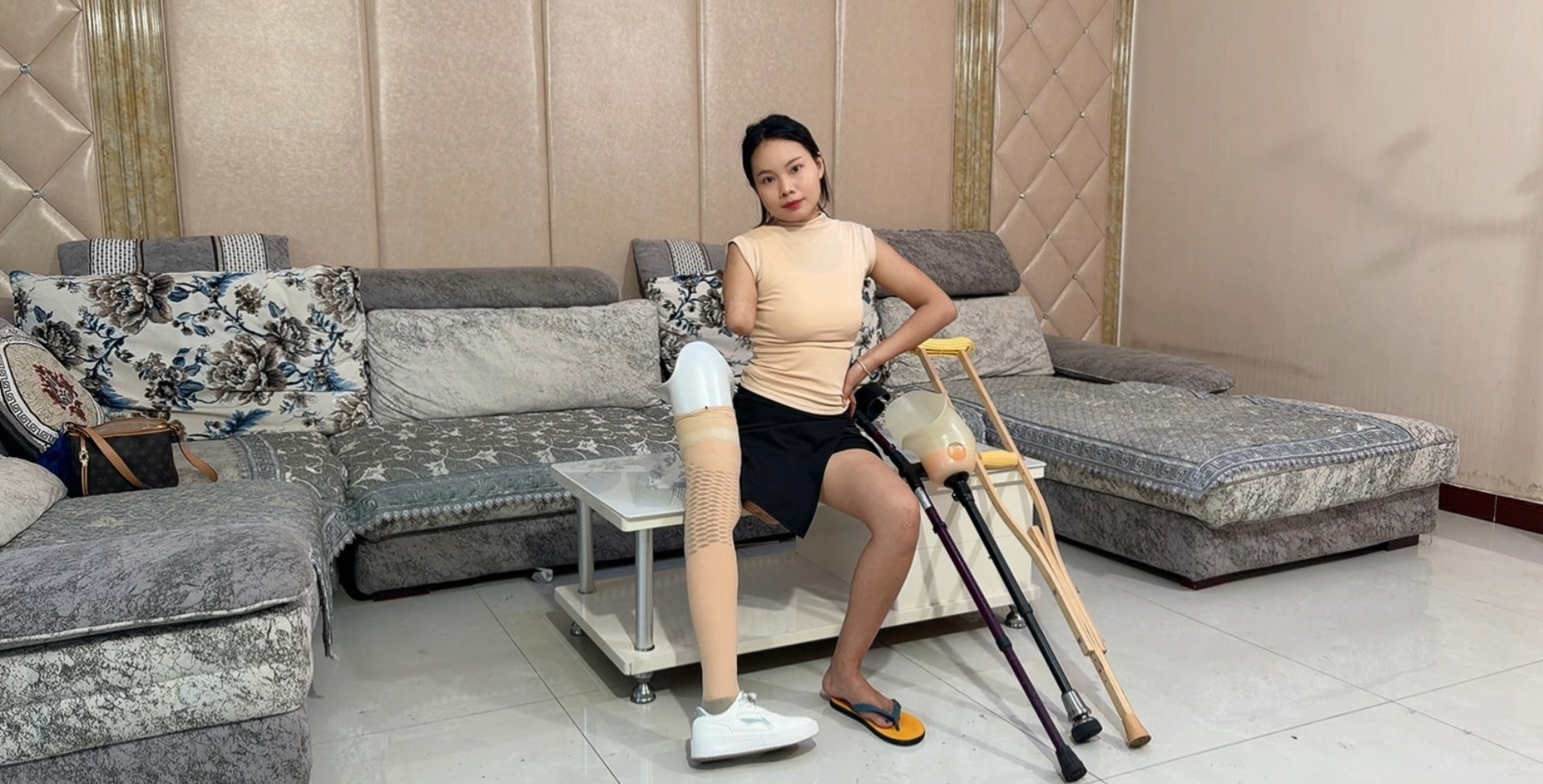 Abby Ooe, the Amputee Girl - From Prosthetic Legs to Wooden Legs