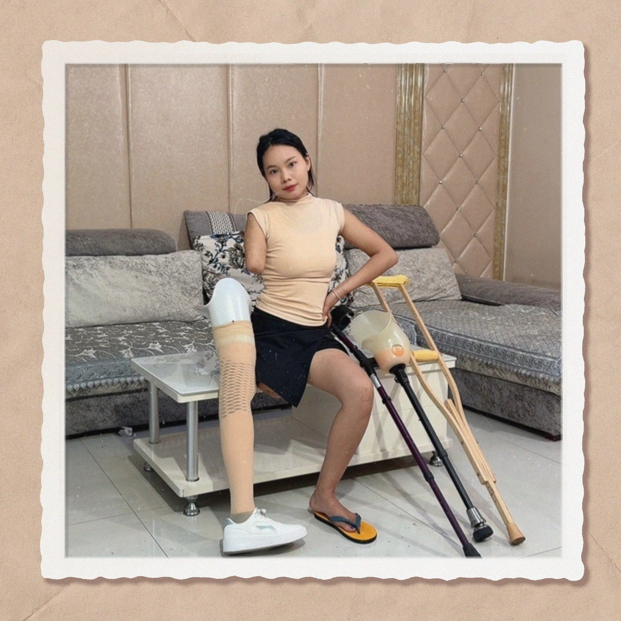 Abby Ooe, the Amputee Girl - From Prosthetic Legs to Wooden Legs
