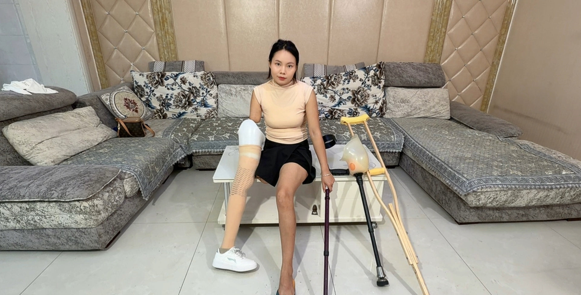 Abby Ooe, the Amputee Girl - From Prosthetic Legs to Wooden Legs