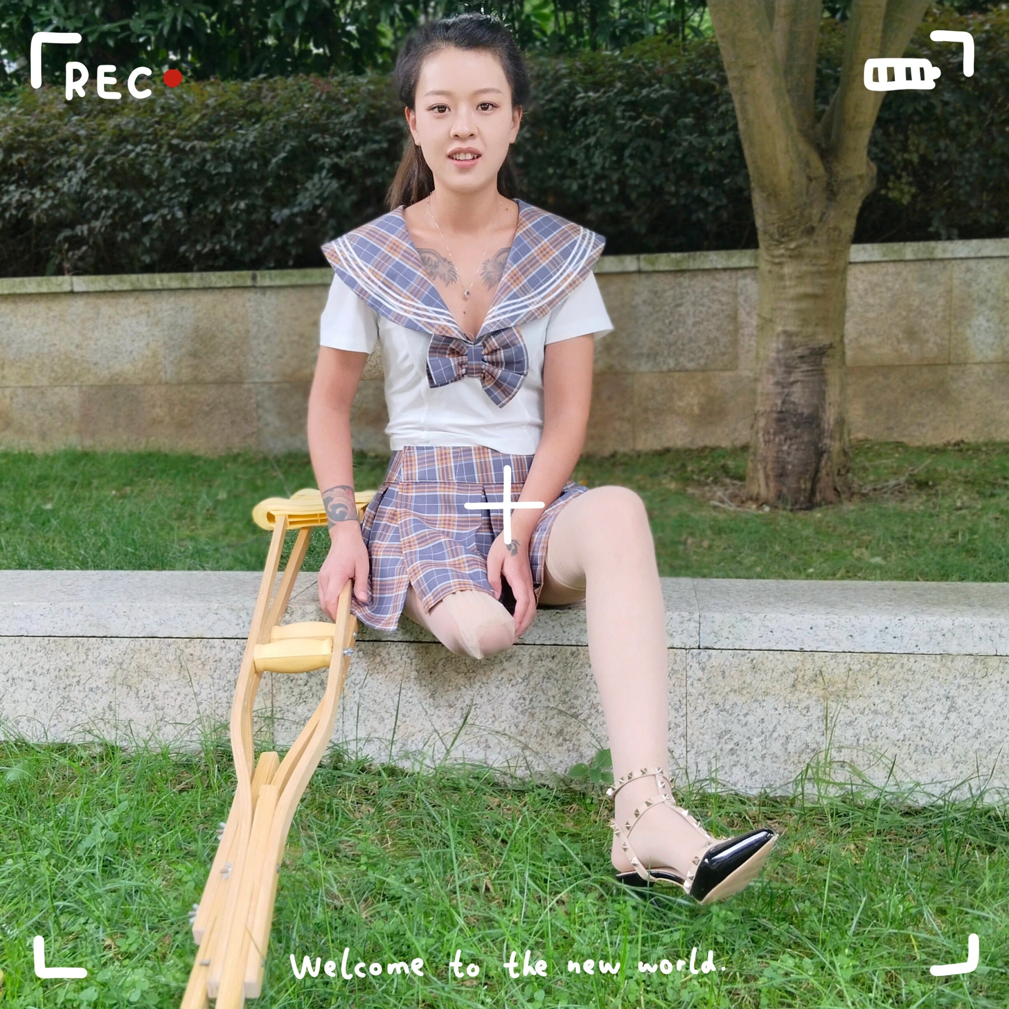 Amy: Sak Amputee Girl – Soothing residual limb pain on a park bench