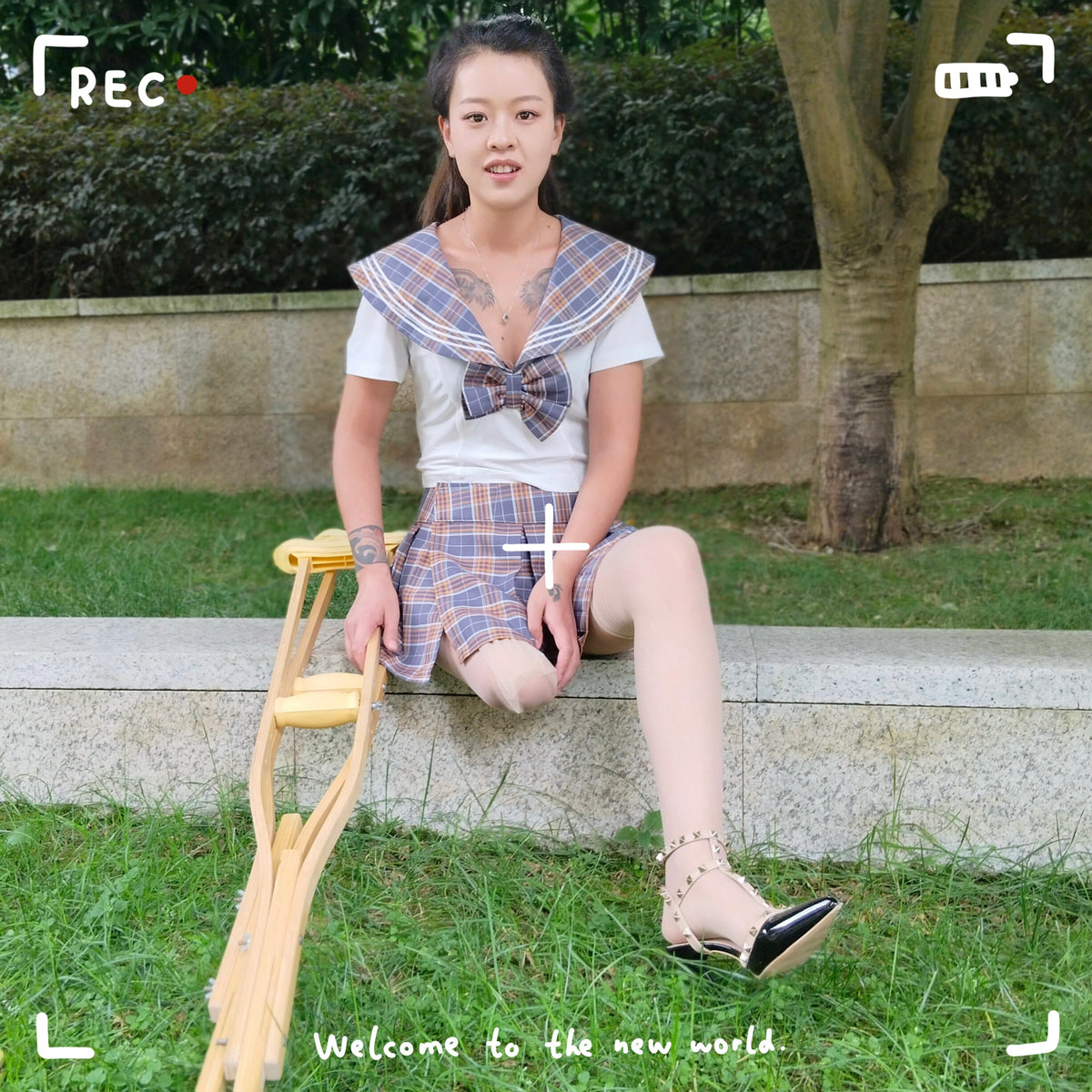 Amy: Sak Amputee Girl – Soothing residual limb pain on a park bench