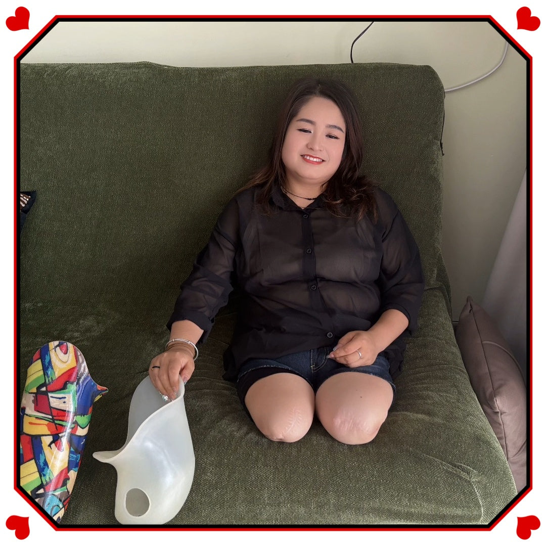Tina, an Amputee Girl – Trying Out a Peg Leg and a Prosthetic Leg