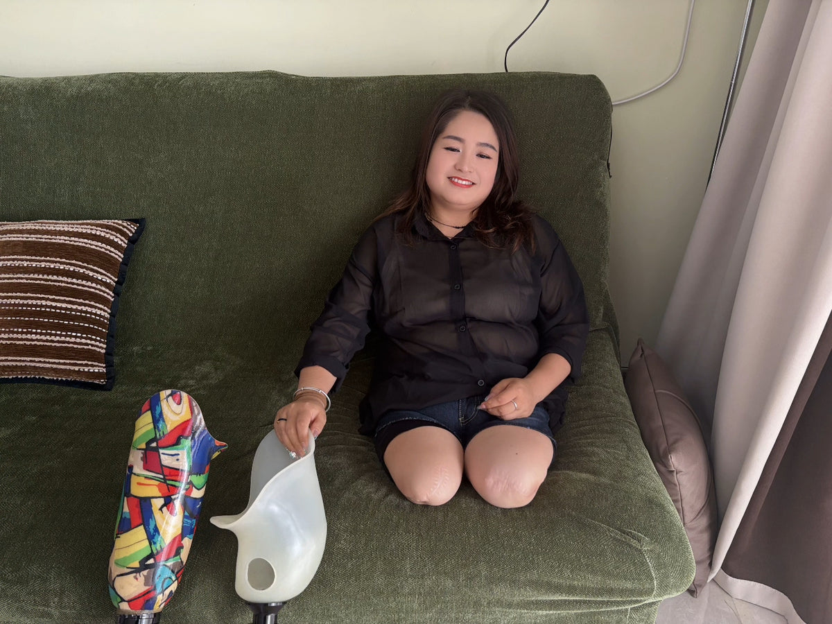 Tina, an Amputee Girl – Trying Out a Peg Leg and a Prosthetic Leg