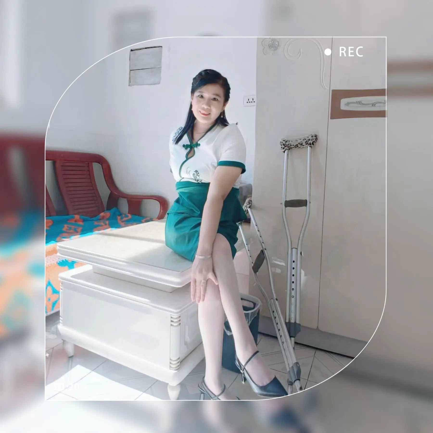 Carrie: Polio lady playing with her slender legs AmputeeClub