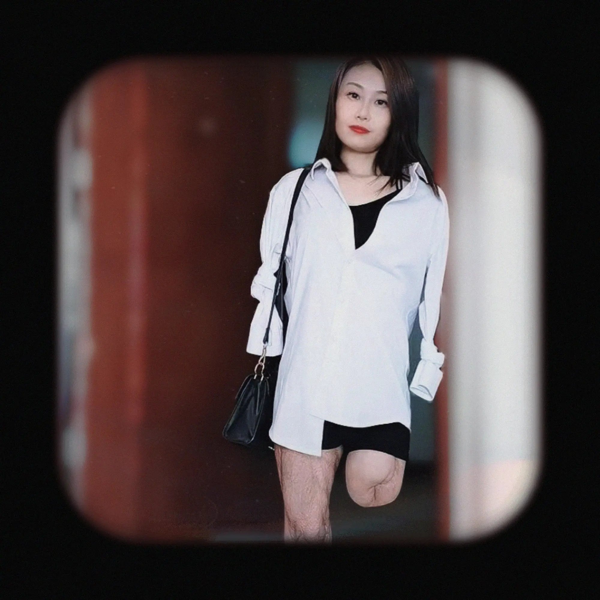 Ayla:Sak Amputee Girl Pretended Triple Amp AmputeeClub