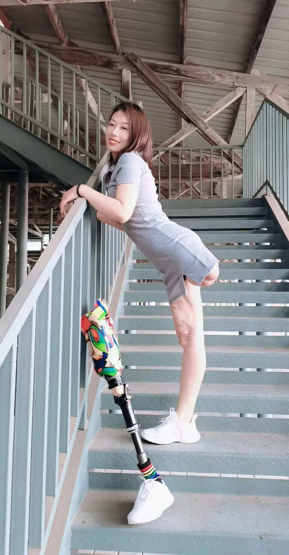 Ayla: Sak Amputee Girl uses elbow crutches