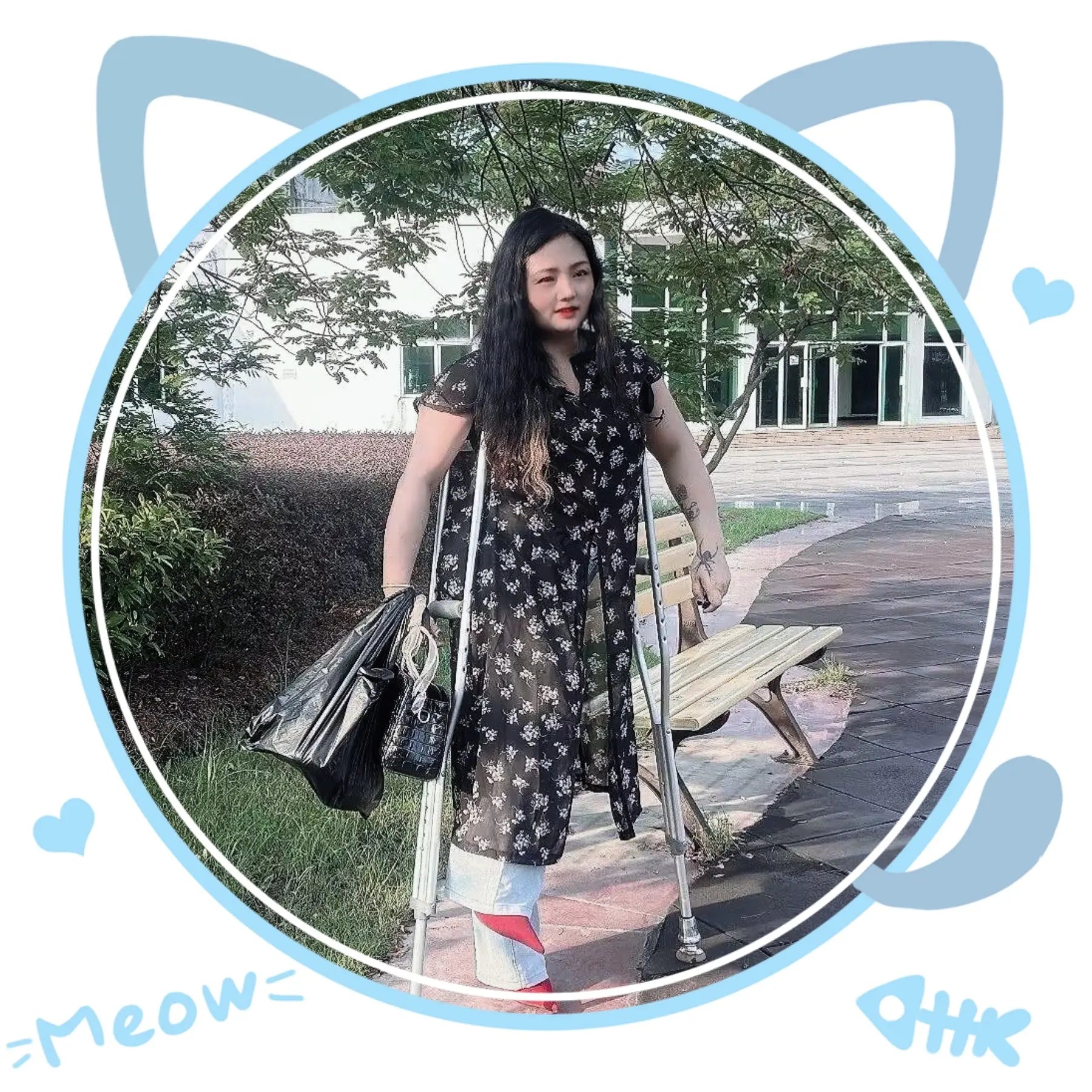 Elizabeth: Polio Lady's unique walking posture AmputeeClub