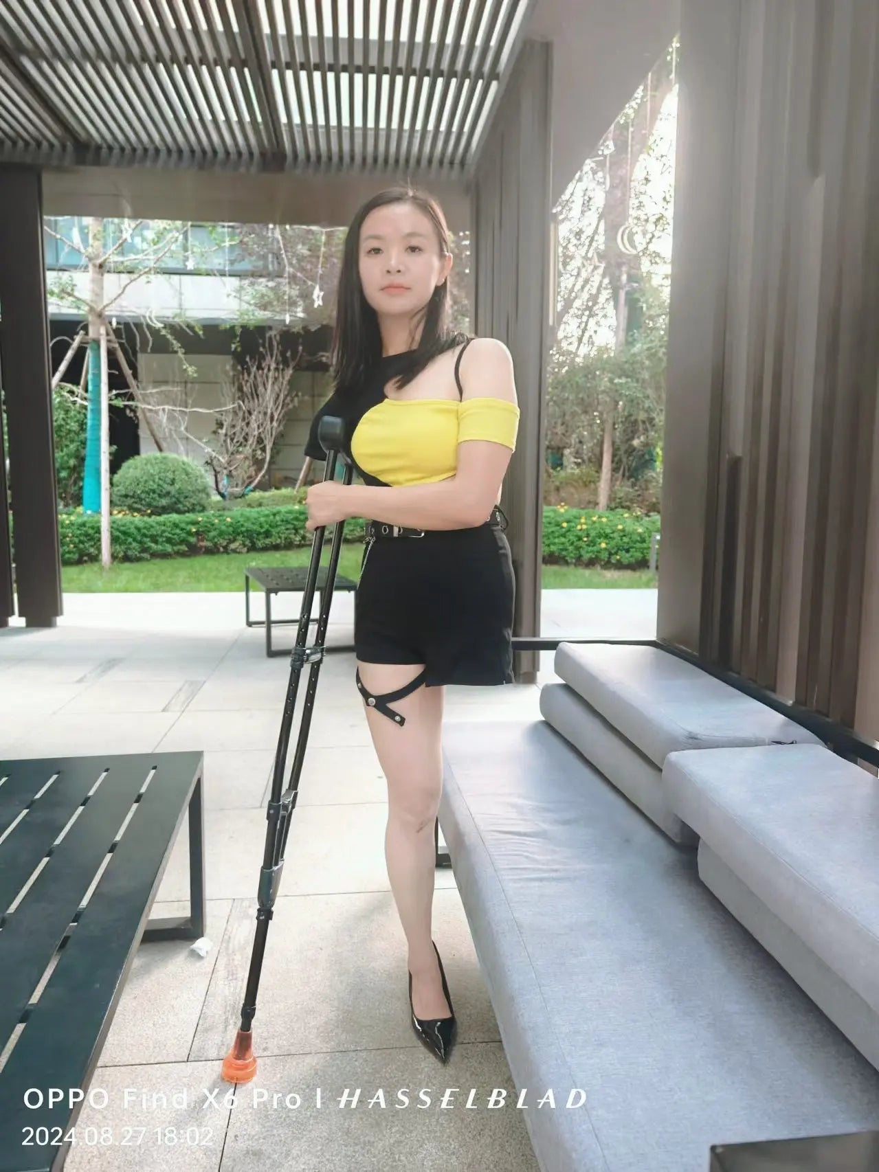 Mila: Ooe Amputee Girl - Plateau Morning Walk Adventure