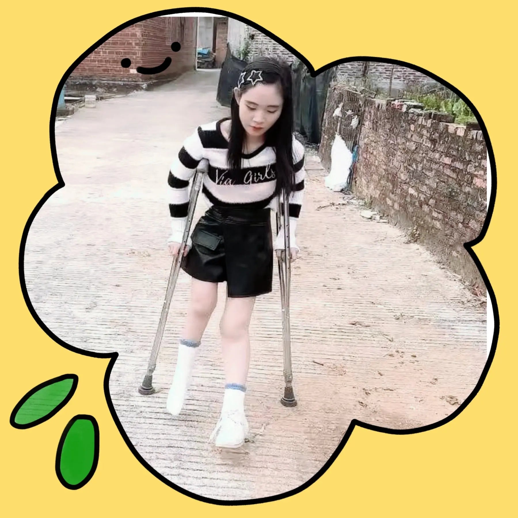 Lolicc:Polio Girl -Go home AmputeeClub