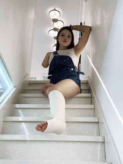 Abby: Ooe Amputee Girl - The Only Leg Cast