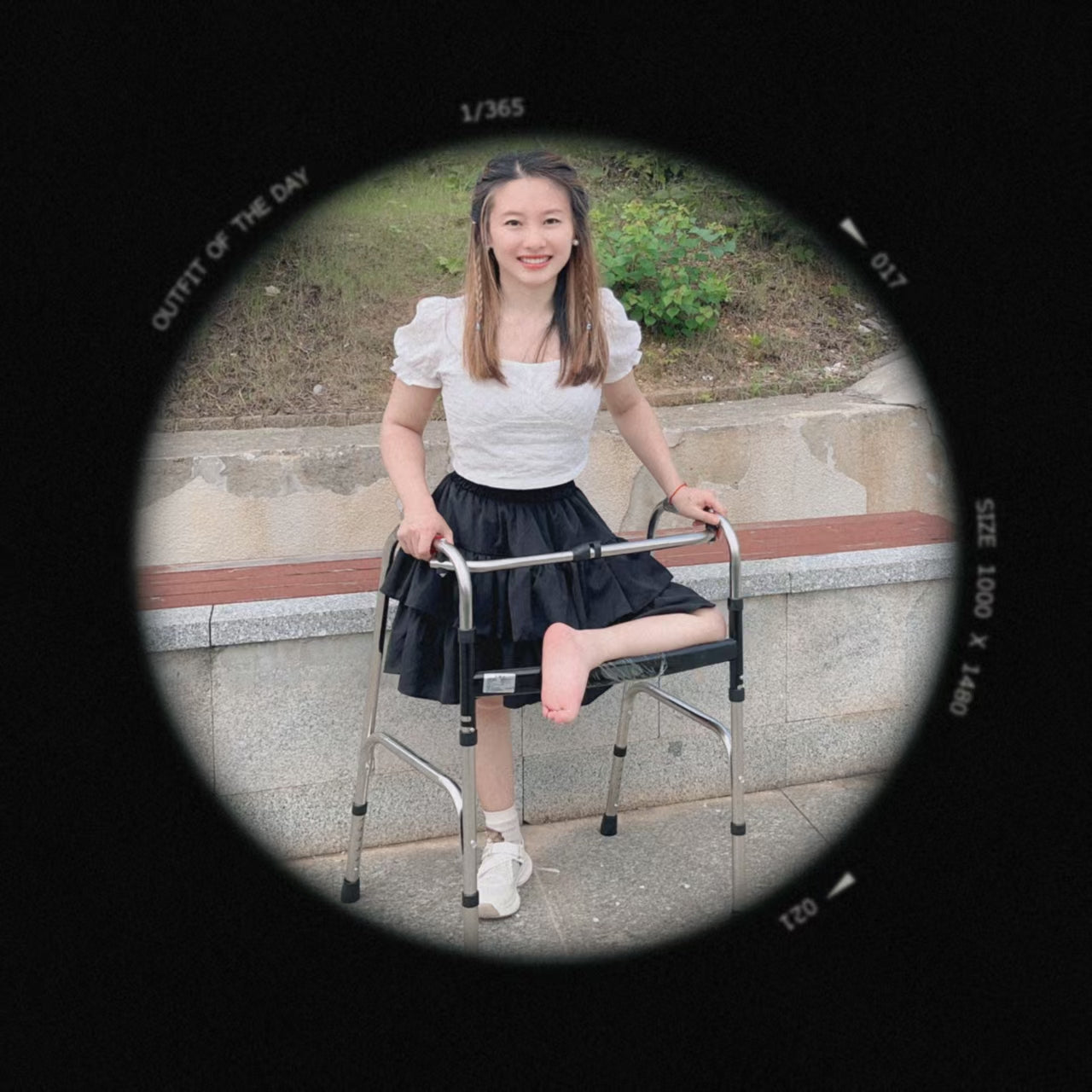 Miki: Polio Girl - Curved and Deformable Legs