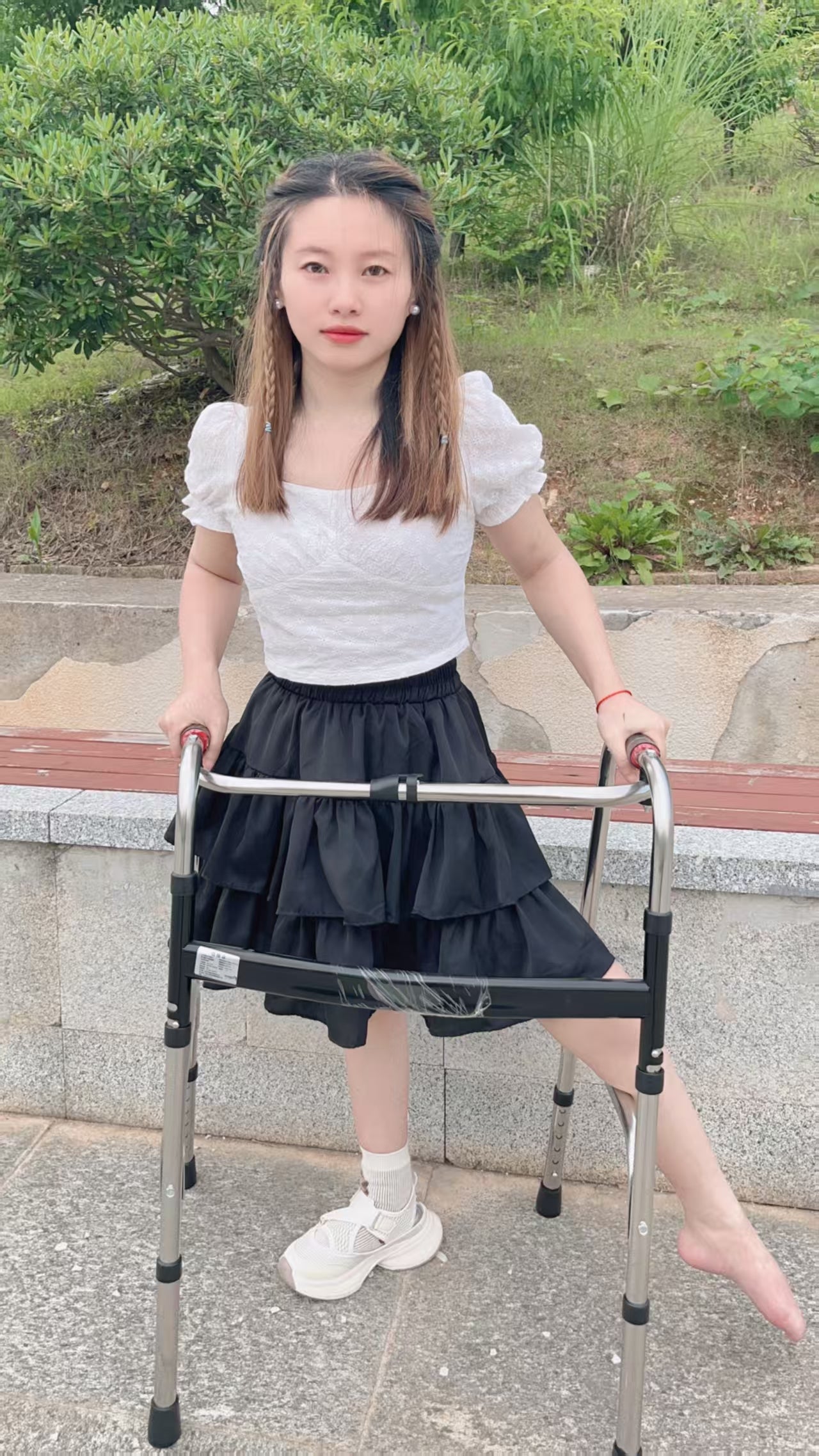 Miki: Polio Girl - Curved and Deformable Legs