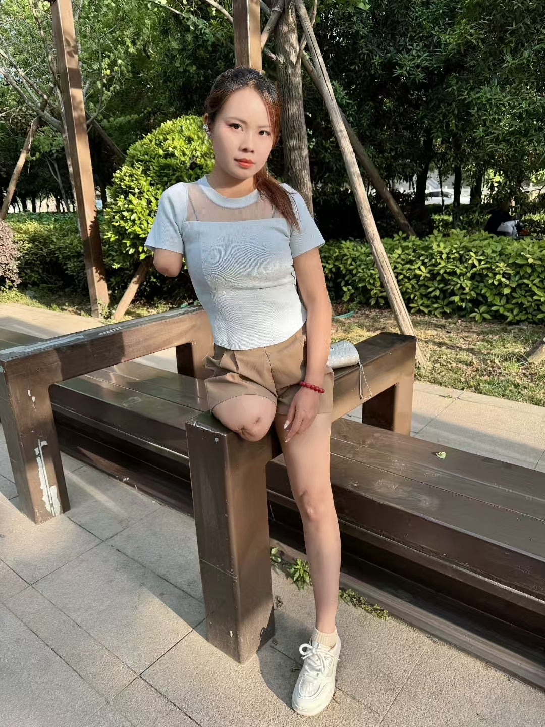 Abby: Ooe Amputee Girl - hopping under the city walls - AmputeeClub