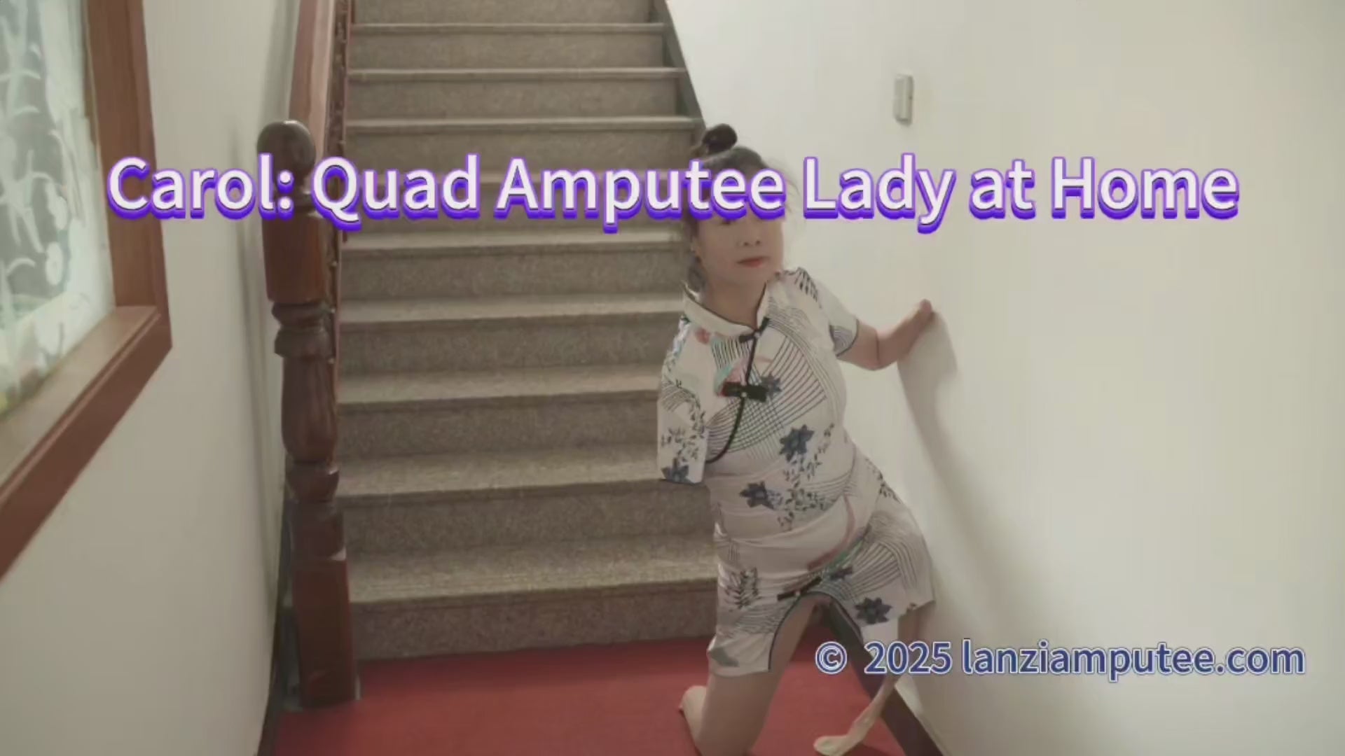 Carol: Quad Amputee Lady - Daily Life at Home